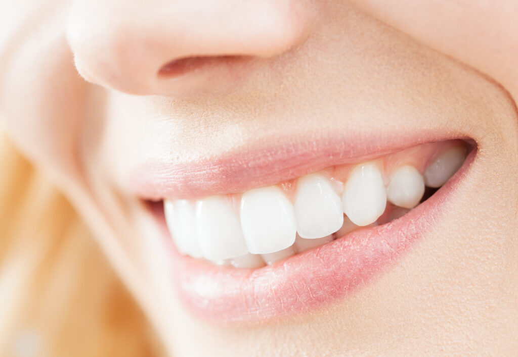 Teeth Whitening Dallas